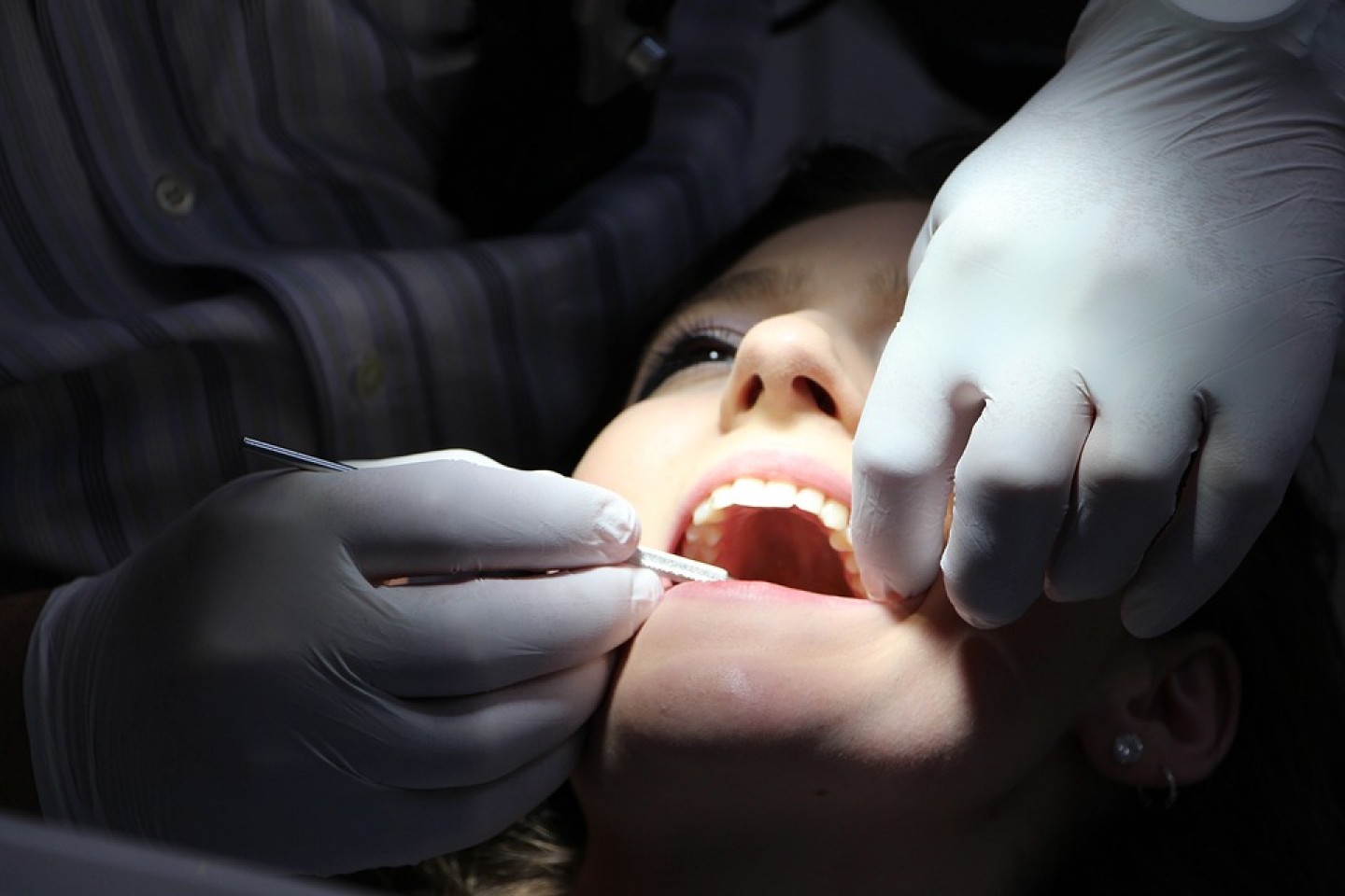 Uklonite zubni kamenac bez bolova