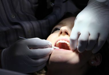 Uklonite zubni kamenac bez bolova